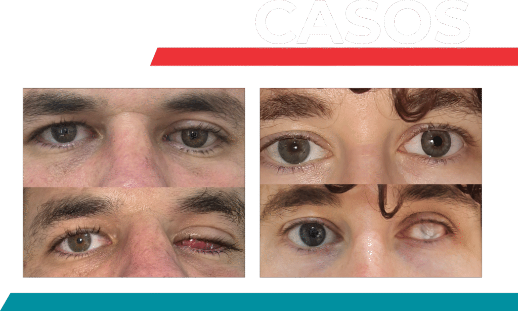 CASOS